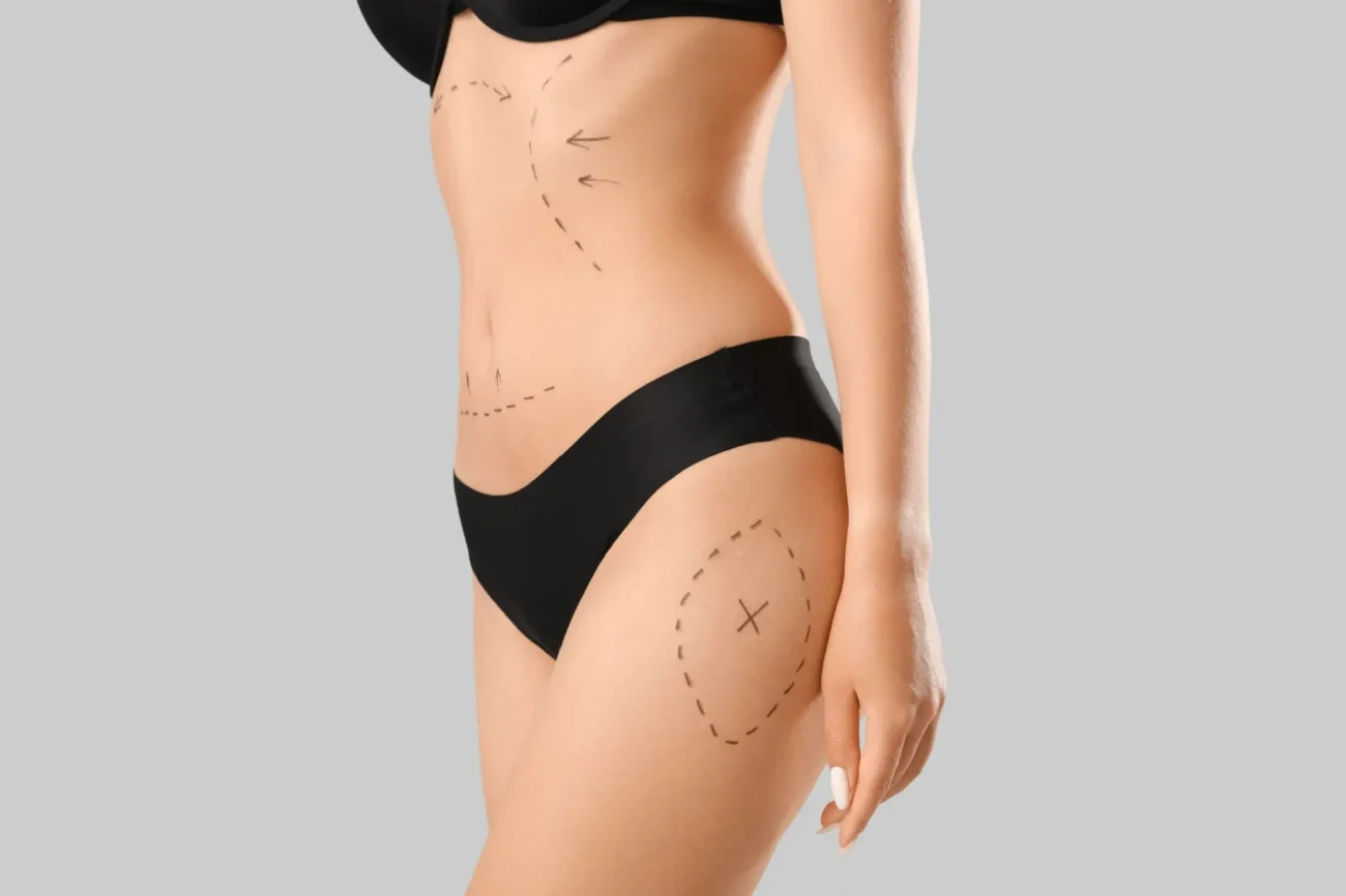 plastickáHcirurgi | TVGURU.cz žena před plastickou operací