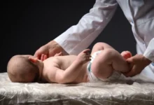 Doktor pečuje o miminko.